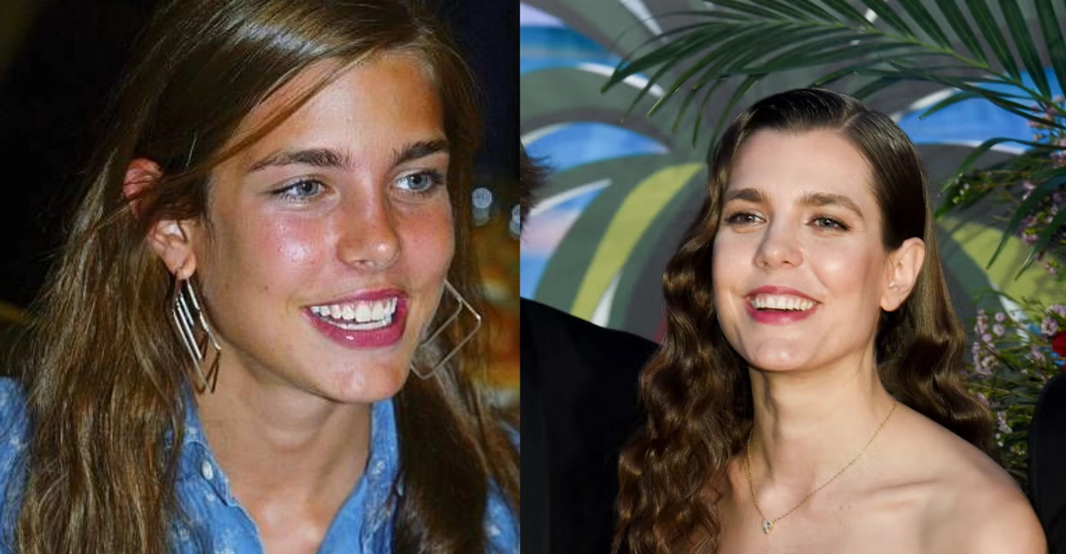 Charlotte Casiraghi teeth